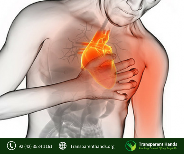 Symptoms and Causes of Stroke that We All Need to Know