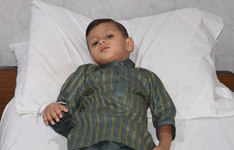 colostomy ahad