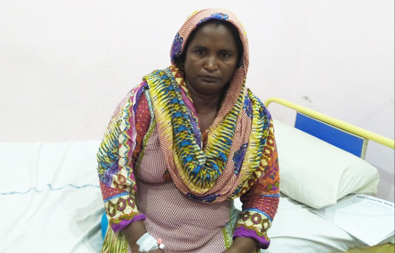 umbilical hernia