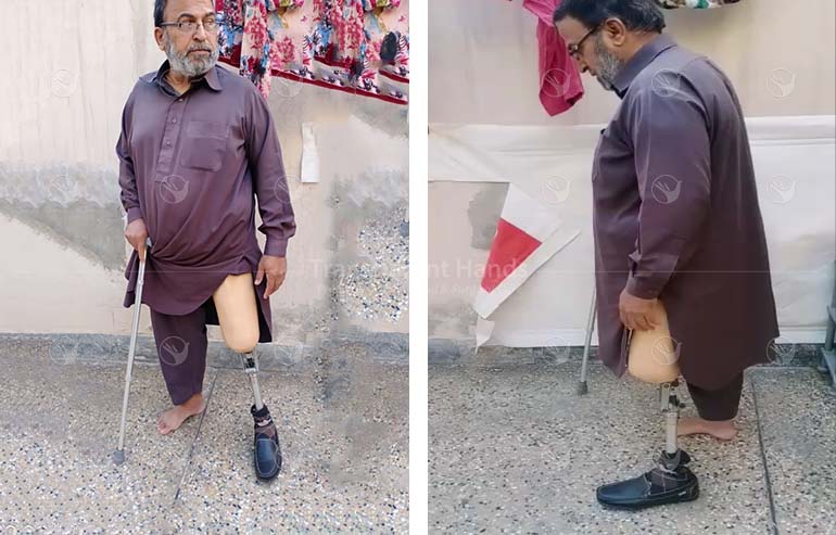 You helped a man walk again!