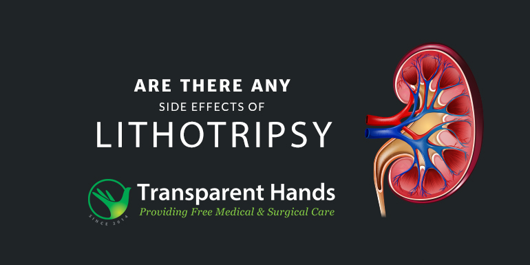 Side Effects of Lithotripsy