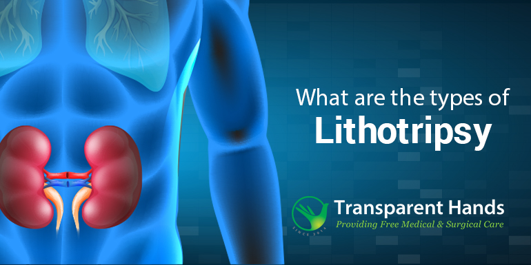Types of Lithotripsy