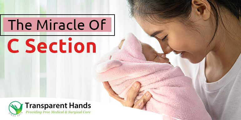 The Miracle of C-section
