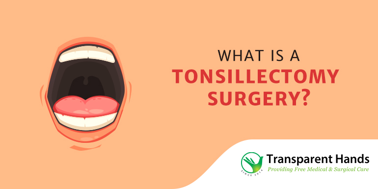 What is tonsillectomy surgery?