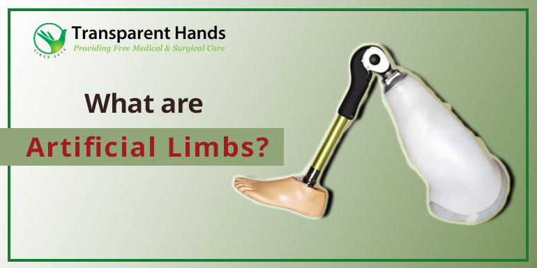 what are artificial limbs