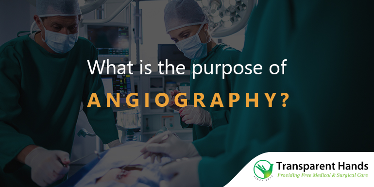 Angioplasty after a heart attack and its procedure | Transparent Hands