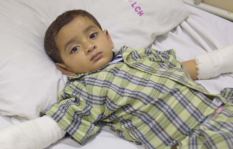 Umar’s contracture release surgery