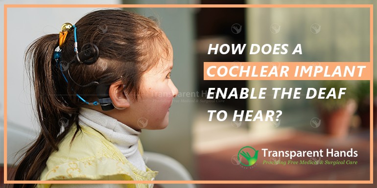 cochlear implant enable the deaf to hear