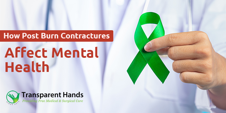 Post-Burn Contractures