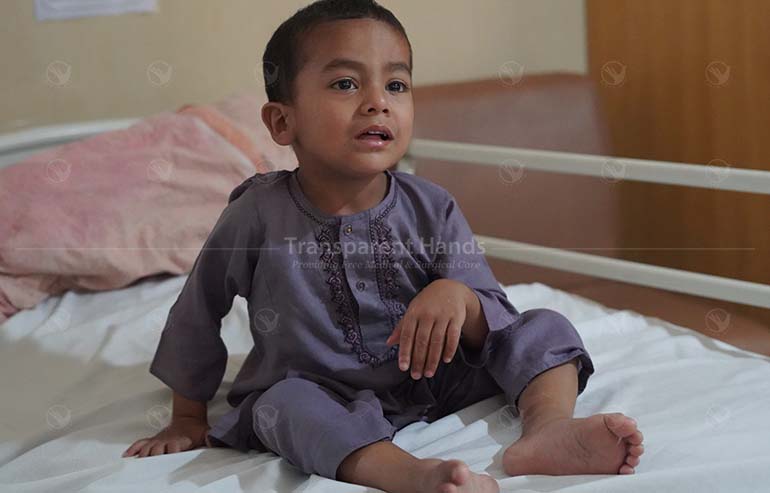 Ahmad’s hernia