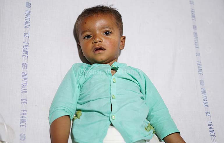 ileostomy reversal surgery