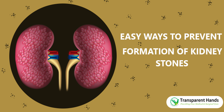 Prevent Kidney Stones