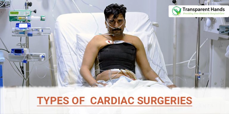 Types of Cardiac Surgeries