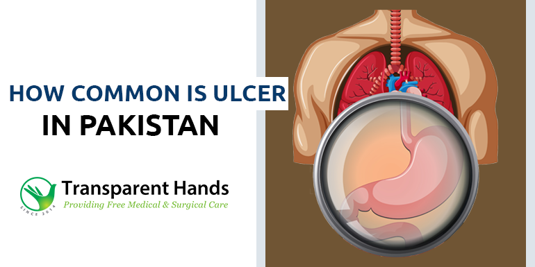 Stomach Ulcer In Pakistan