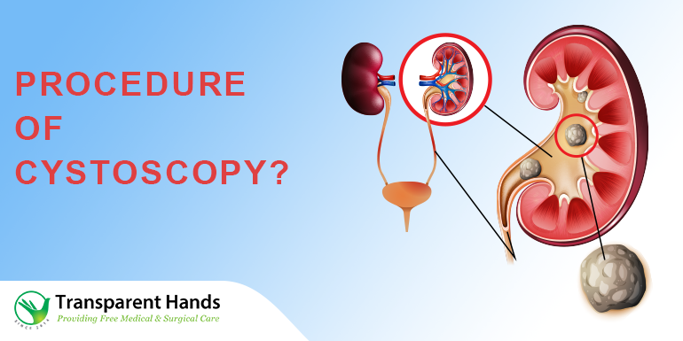 What is Cystoscopy?