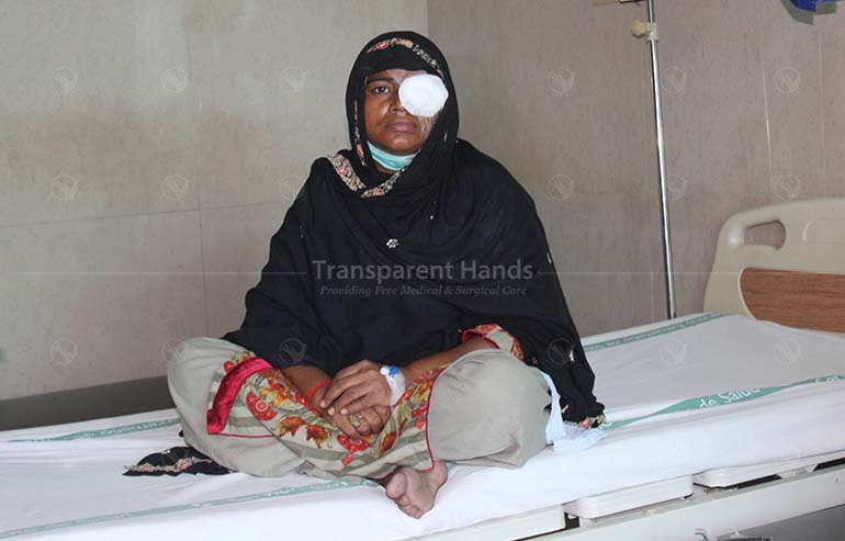 Shamim Akhtar’s cataract