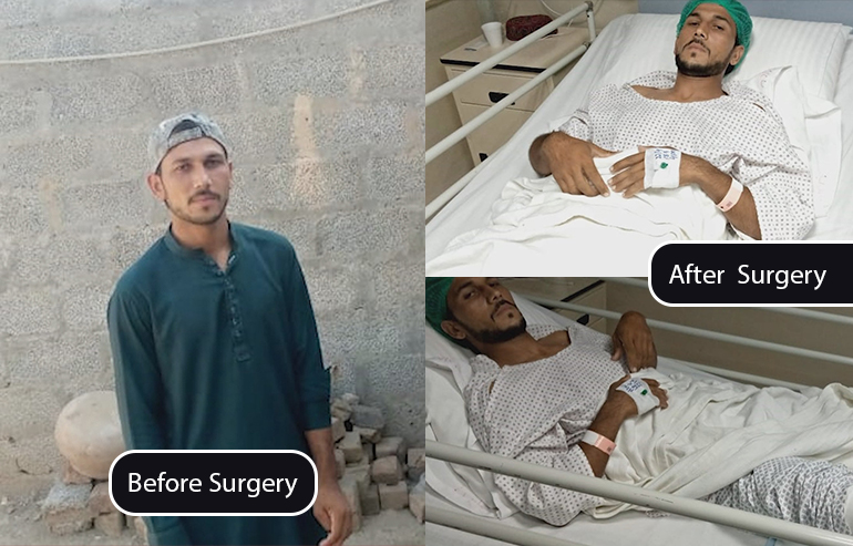 Meer Afzal Khan ACL surgery