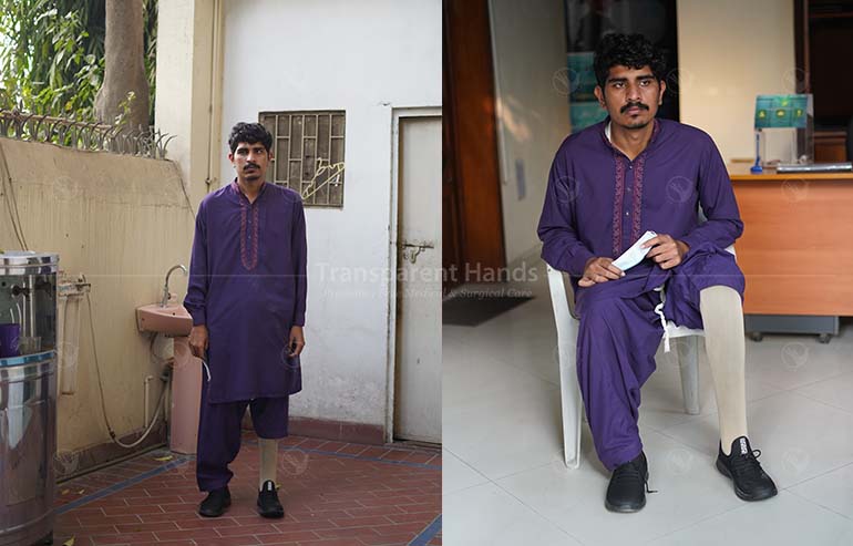 Hassan was provided with knee Prosthesis