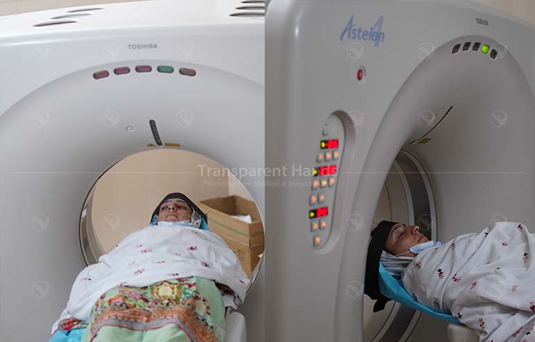 Shumaila Noor CT Scan