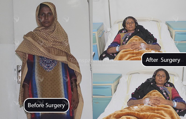 Sughran Hip Replacement