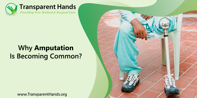 Why Amputation Is Becoming Common (1)