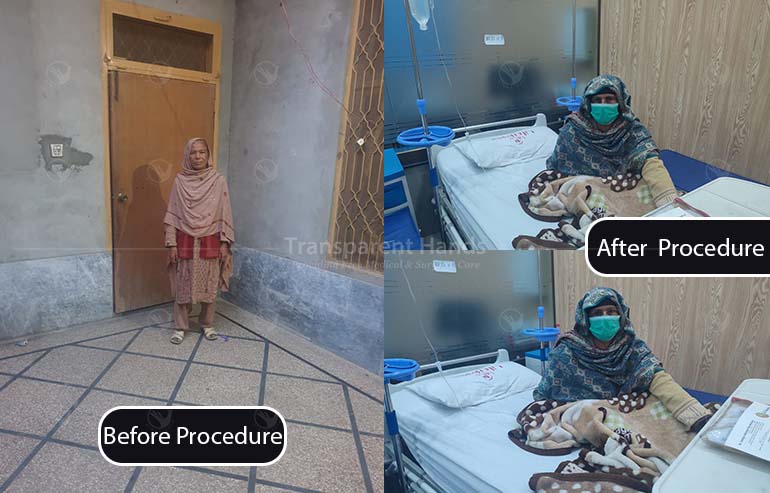 Zareena Bibi Chemotherapy sessions