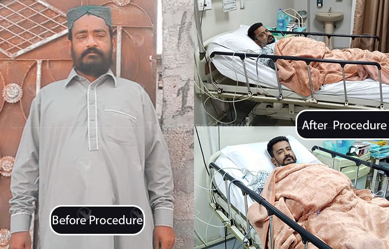 Shamim Uddin’s Angiography was successfully performed