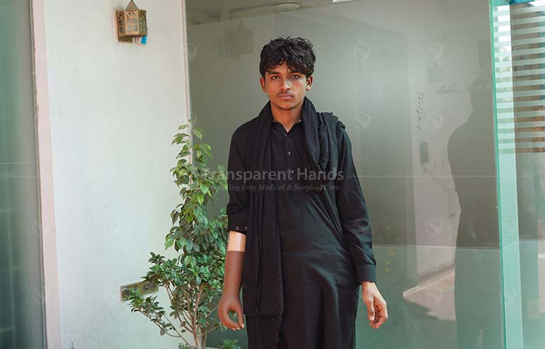 Ahmed Sher prosthetic arm