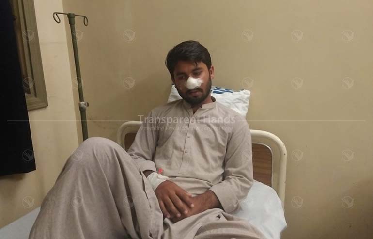 Amjad Ali’s Submucosal Resection