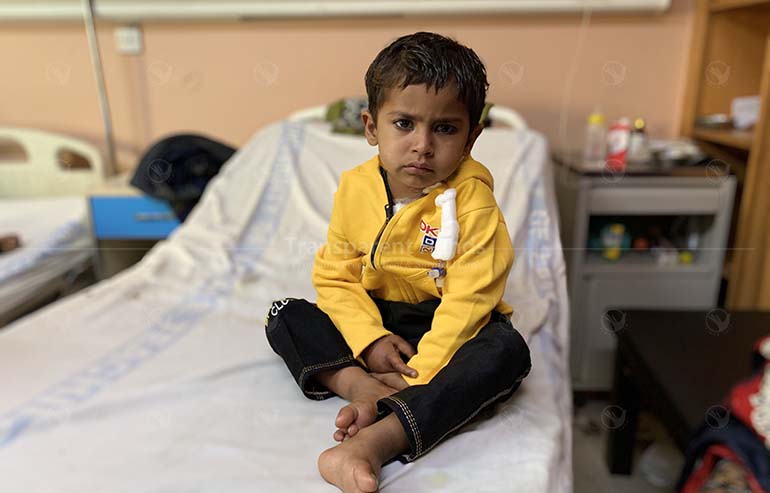 Awais Shahnawaz open heart surgery