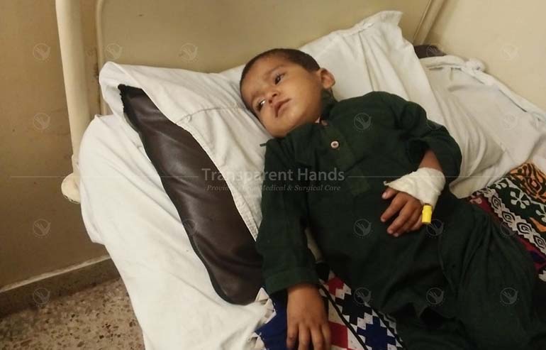 Khalil Rehman PPV ligation