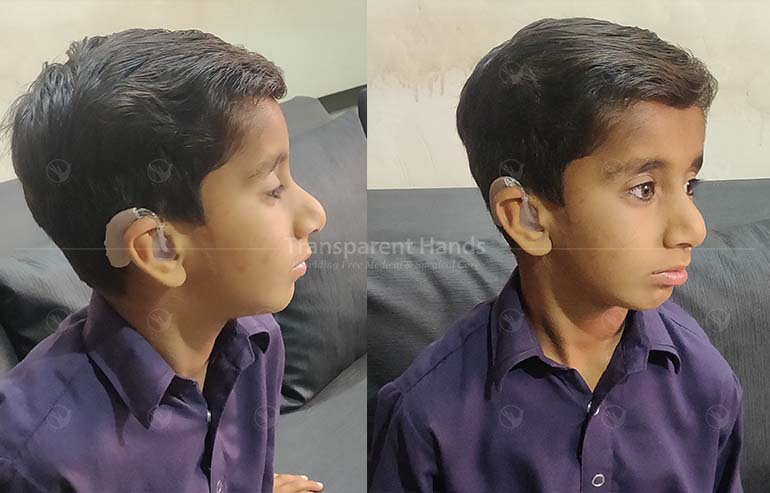 Muhammad Muzakkir cochlear implant