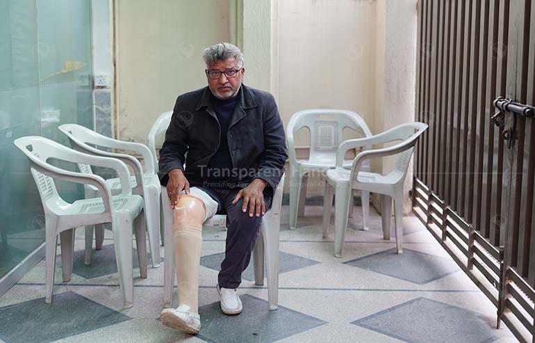 Muhammad Saleem amputation