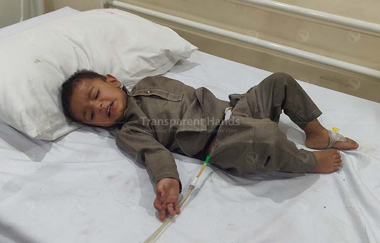 Muhammad Yousaf Urethroplasty