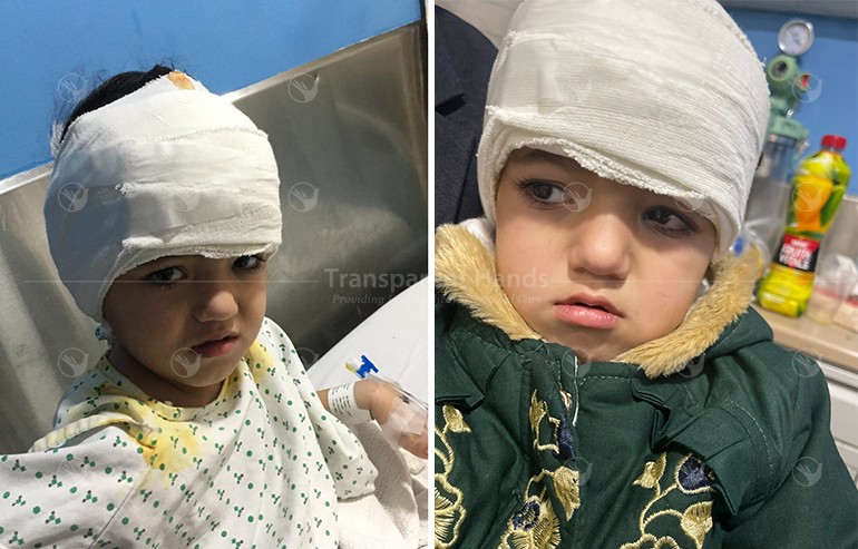 Ayeza Shah’s Cochlear Implant