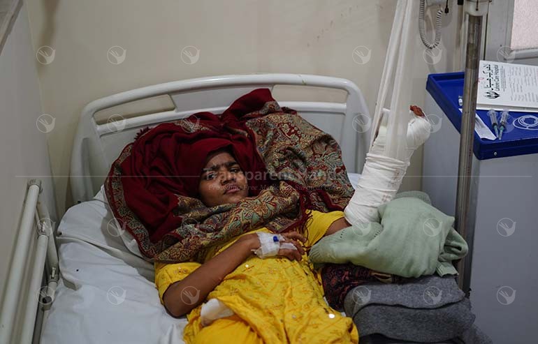 Farzana Bibi’s contracture release surgery