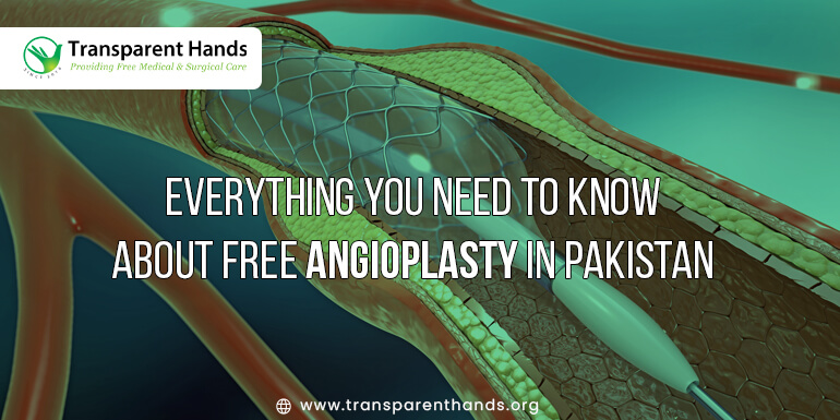 Free Angioplasty in Pakistan