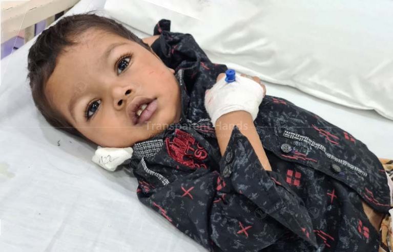 Hussain Ali open heart surgery