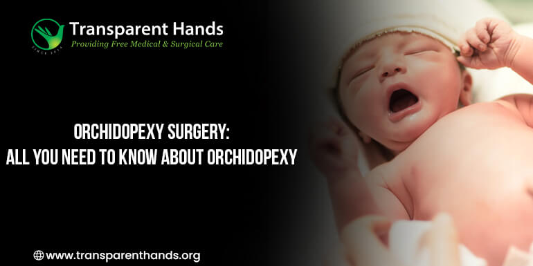 Orchidopexy Surgery