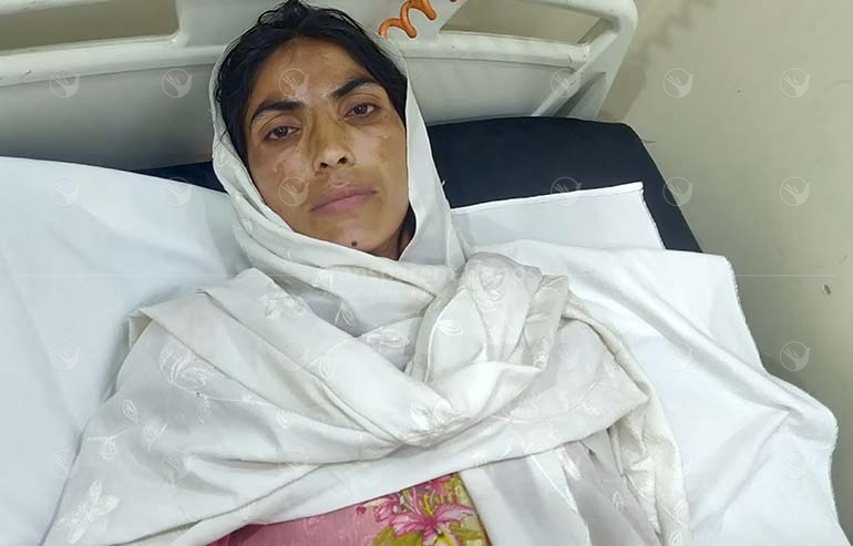 Bushra Bibi’s Open Cholecystectomy Was Successful
