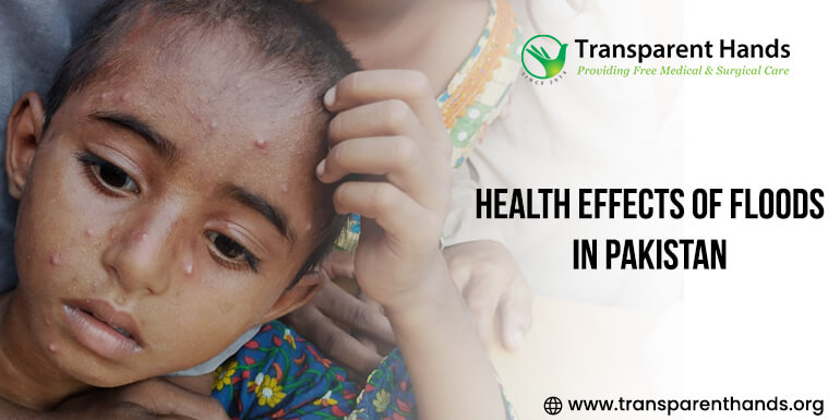 Health Effects of Floods in Pakistan