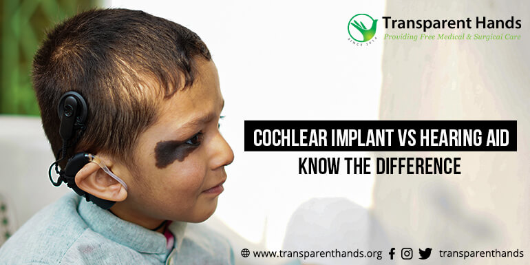 Cochlear Implant vs Hearing Aid