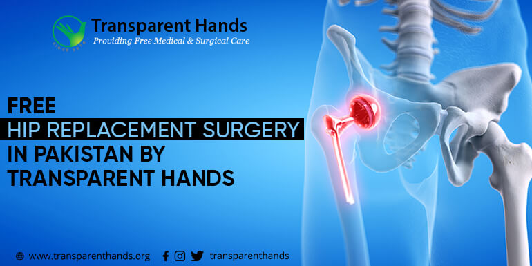 free hip replacement surgery
