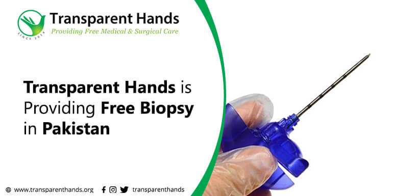 Free Biopsy In Pakistan