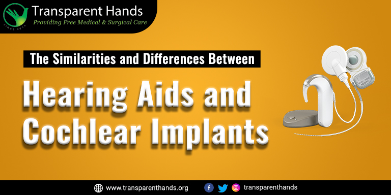 hearing aids vs cochlear implants