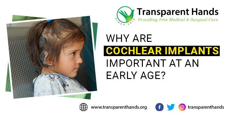 Why Are Cochlear Implants Important at an Early Age