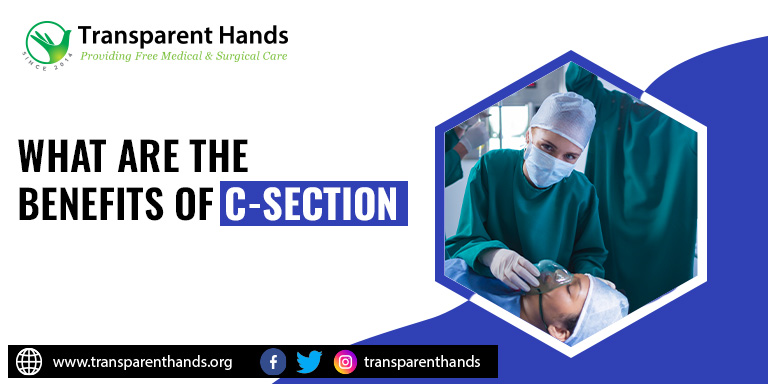 Benefits of C-Section