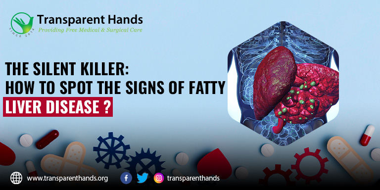 Signs of Fatty Liver Disease