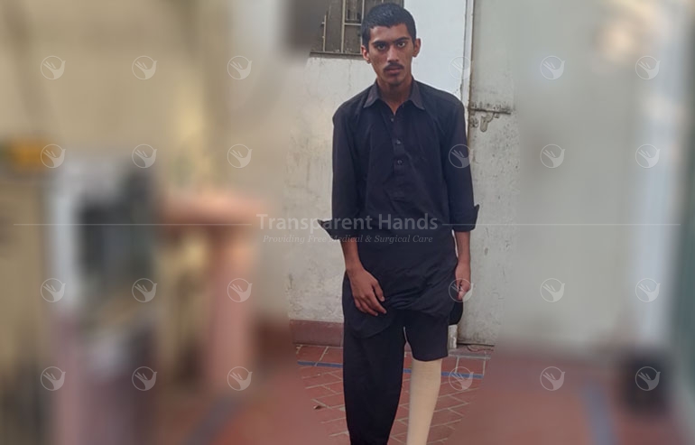 Ali Raza with artificial leg