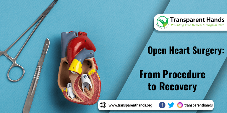 Open Heart Surgery